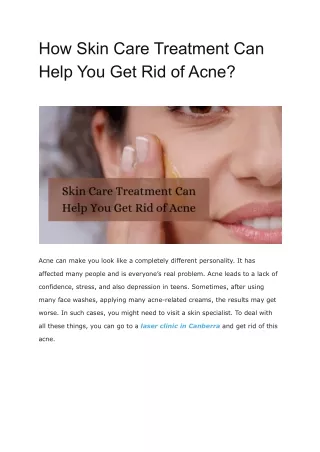 How Skin Care Treatment Can Help You Get Rid of Acne