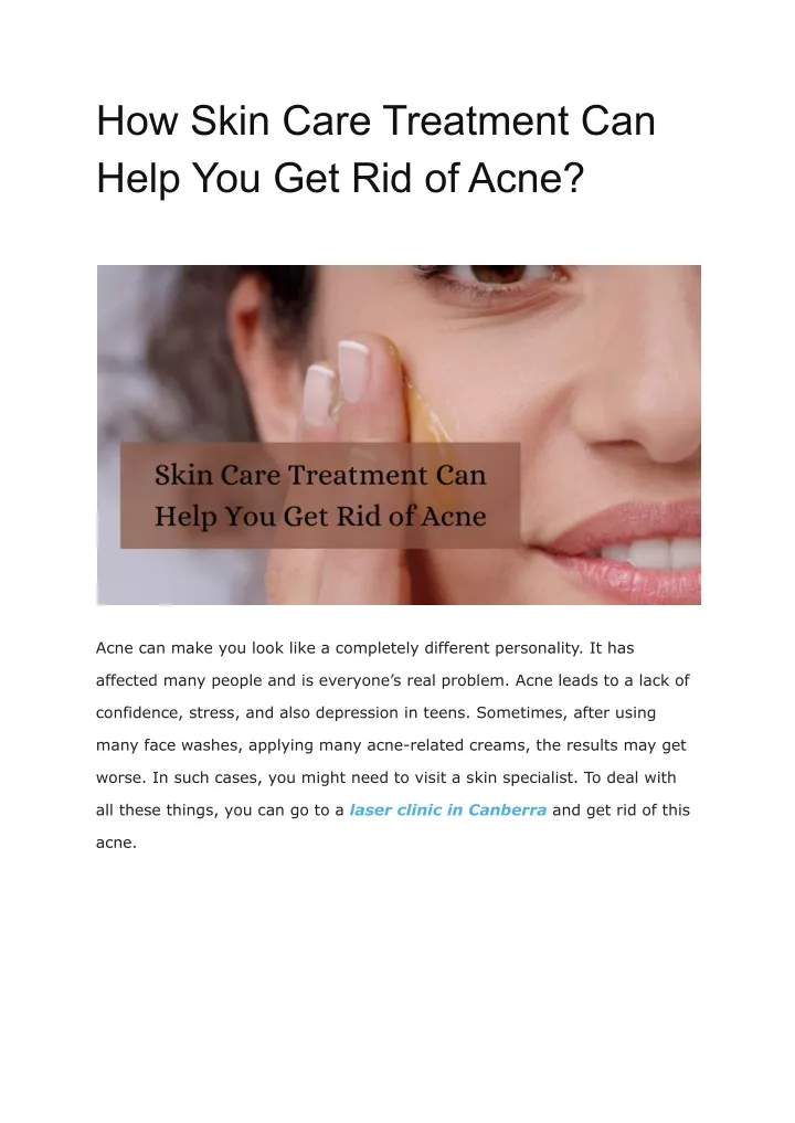 how skin care treatment can help