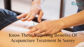 Know These Surprising Benefits Of Acupuncture Treatment In Surrey