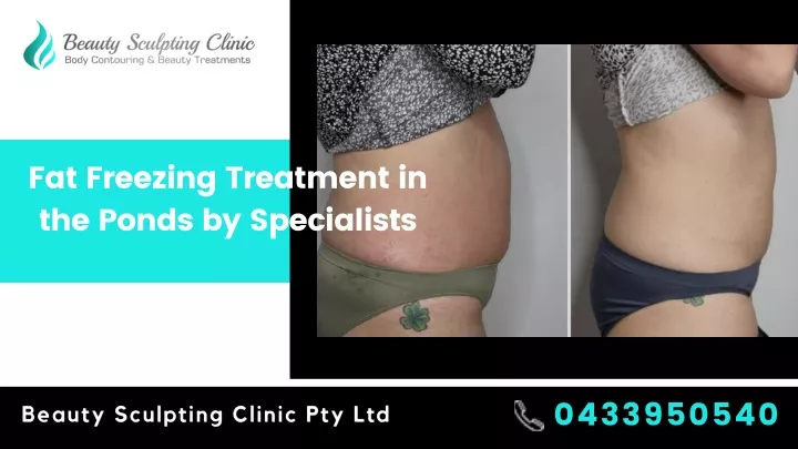 fat freezing treatment in the ponds by specialists