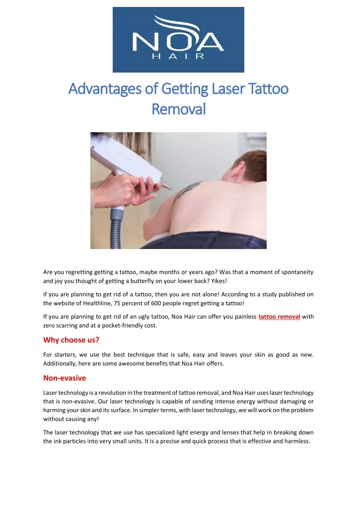 advantages of getting laser tattoo advantages