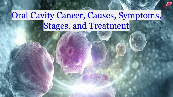 Ppt Oral Cavity Cancer Causes Symptoms Stages And Treatment
