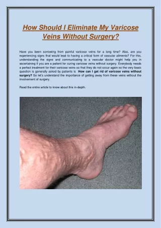 how should i eliminate my varicose veins without