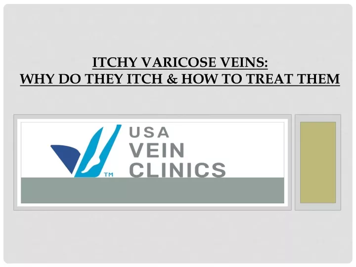 itchy varicose veins why do they itch how to treat them