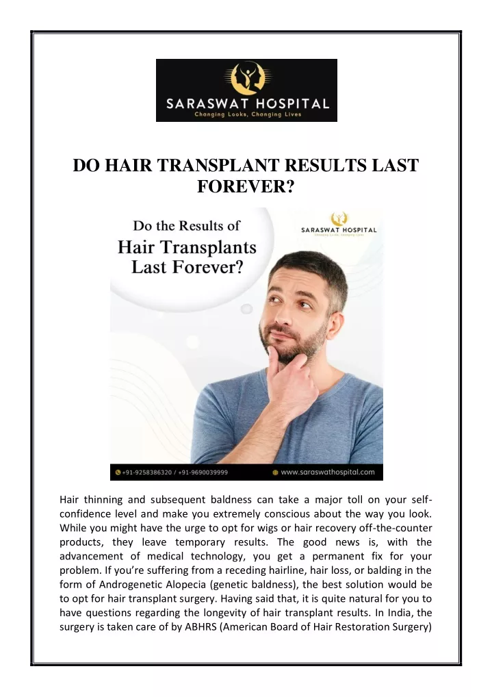 do hair transplant results last forever