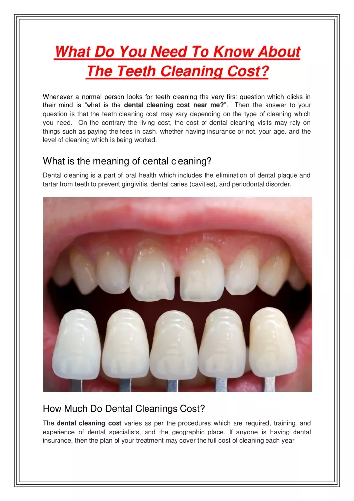 what do you need to know about the teeth cleaning