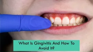 What Is Gingivitis And How To Avoid It?