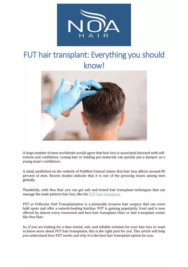 fut hair transplant everything you should