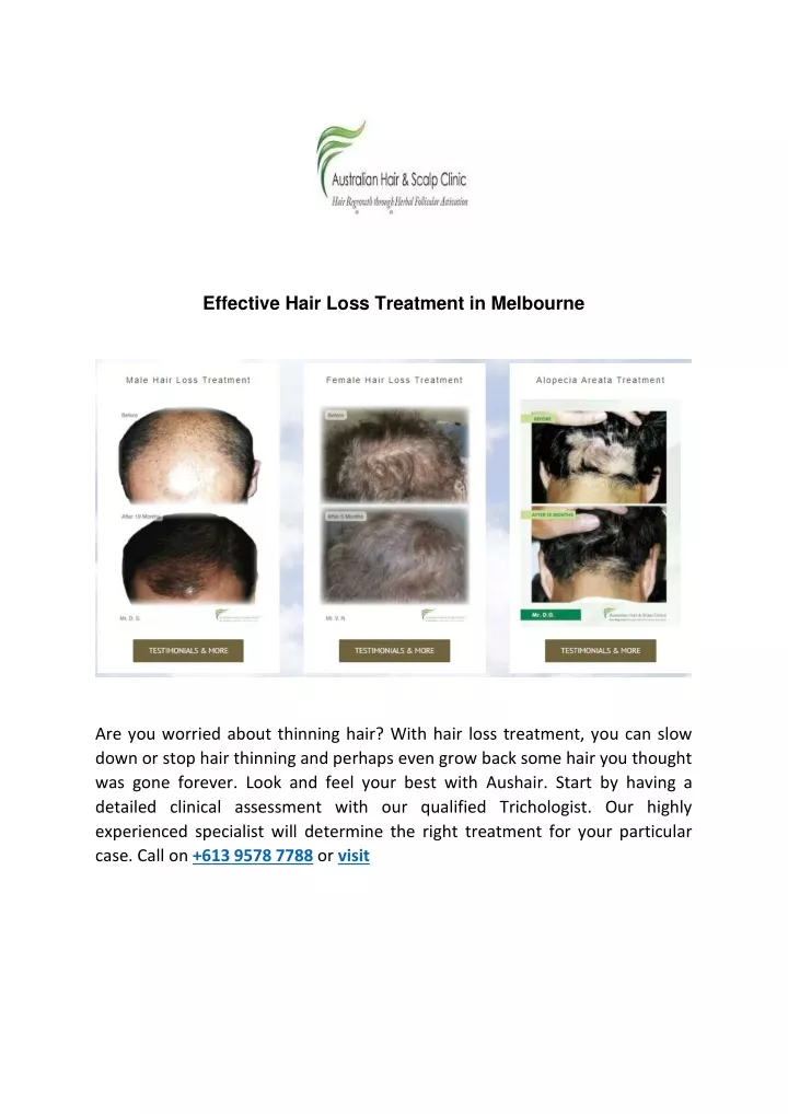 effective hair loss treatment in melbourne