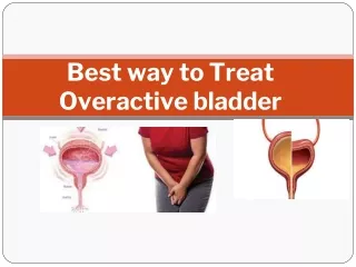 best way to treat overactive bladder