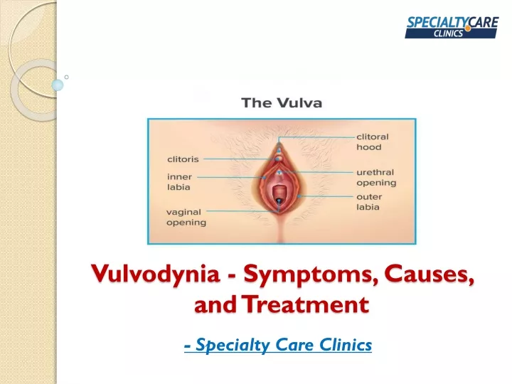 vulvodynia symptoms causes and treatment