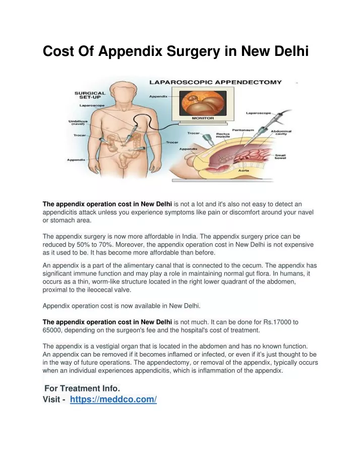 cost of appendix surgery in new delhi