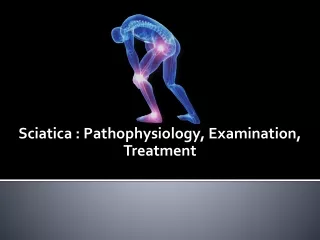 Sciatica