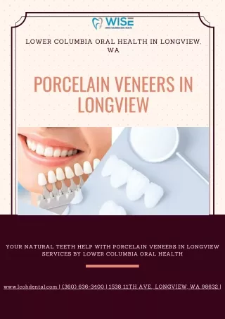 Improving Your Smile With Porcelain Veneers In Longview