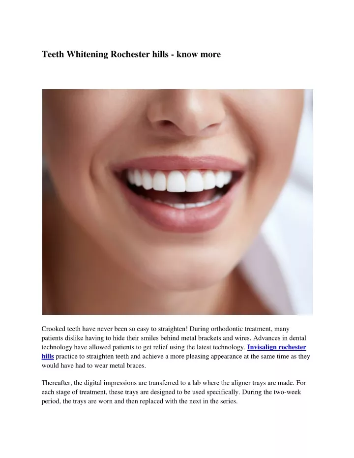 teeth whitening rochester hills know more