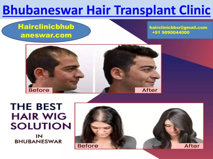 bhubaneswar hair transplant clinic