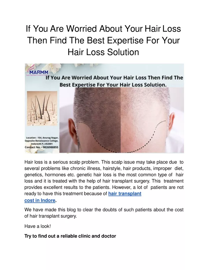 if you are worried about your hair loss then find the best expertise for your hair loss solution