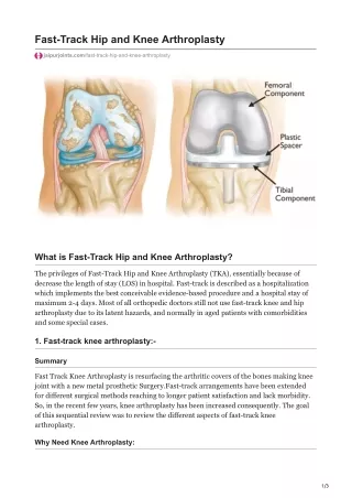 Fast-Track Hip and Knee Arthroplasty in Jaipur