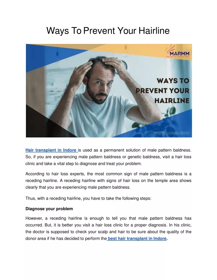 ways to prevent your hairline