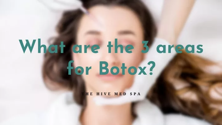 what are the 3 areas for botox