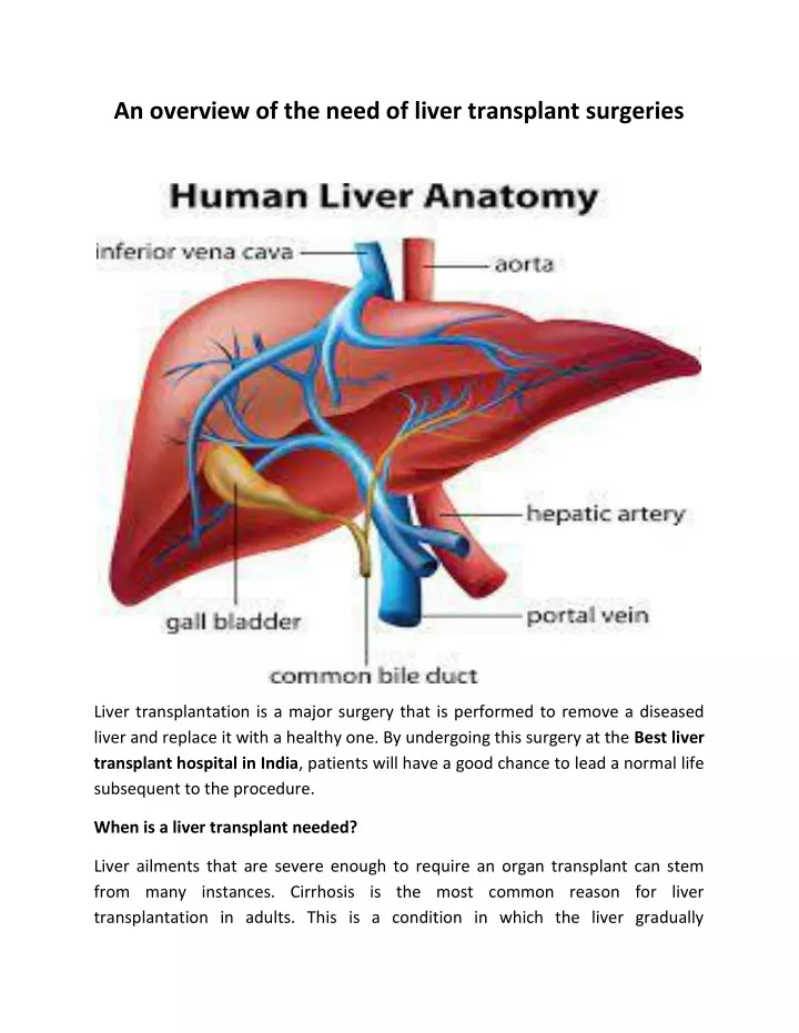 an overview of the need of liver transplant