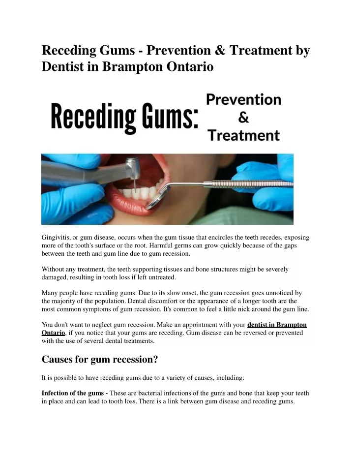 receding gums prevention treatment by dentist in brampton ontario