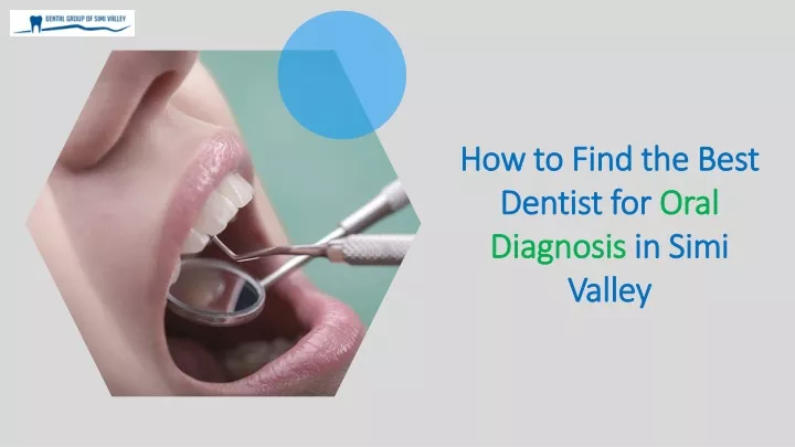 how to find the best dentist for oral diagnosis