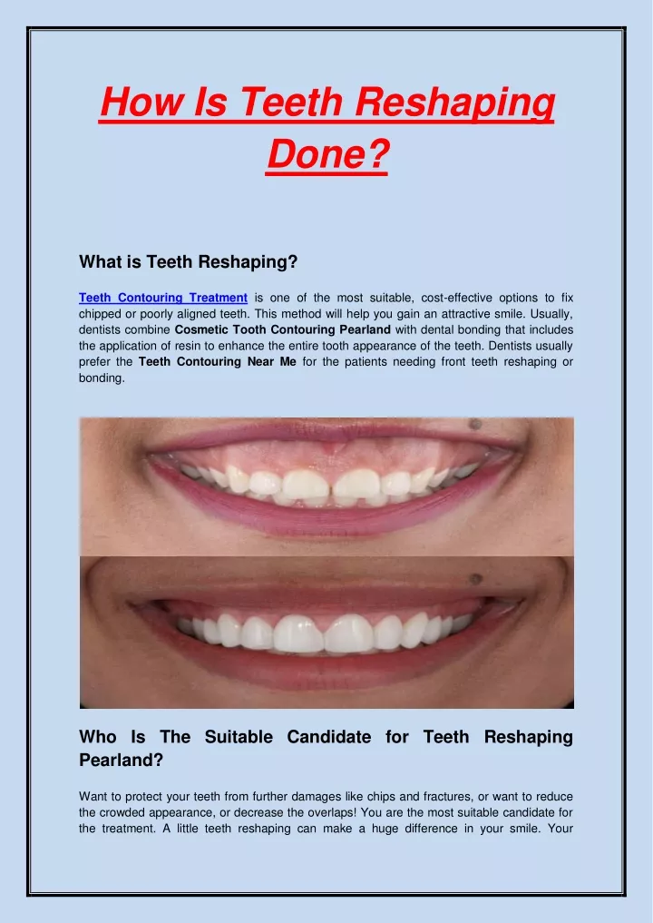 how is teeth reshaping done