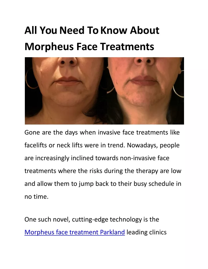 all you need to know about morpheus face treatments