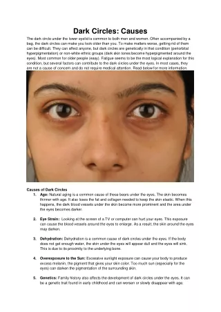 dark circles causes