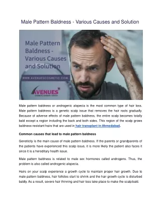 Male Pattern Baldness - Various Causes and Solution