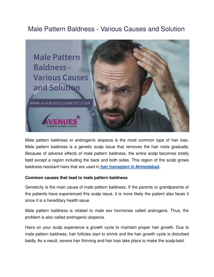 male pattern baldness various causes and solution