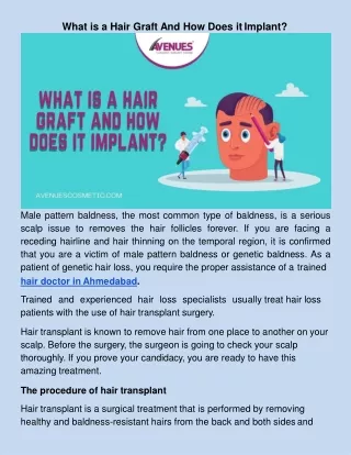​What is a Hair Graft And How Does it Implant?