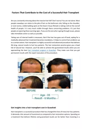 Factors That Contribute to the Cost of a Successful Hair Transplant