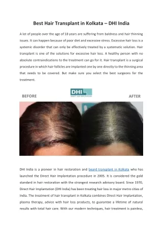 Best Hair Transplant in Kolkata – DHI India