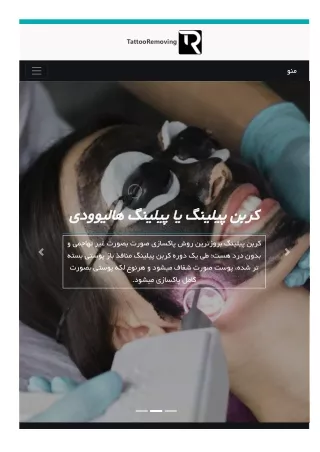 tattooremoving