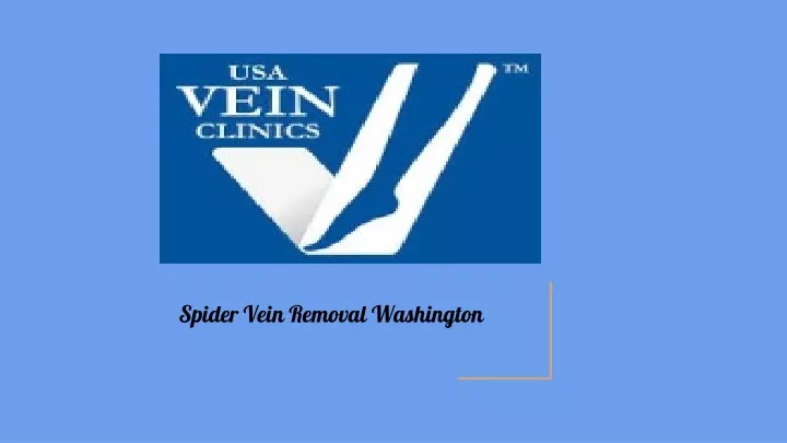 spider vein removal washington