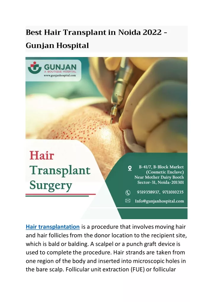 best hair transplant in noida 2022 gunjan hospital