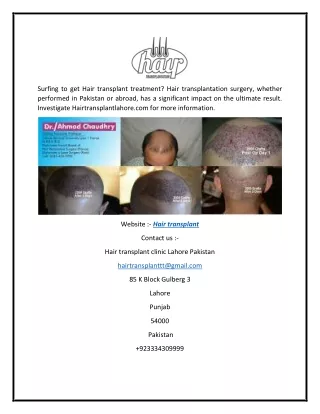 Hair transplant  Hairtransplantlahore.com