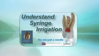 Syringe Irrigation