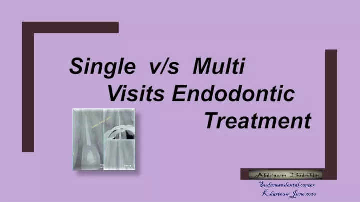 single v s multi visits endodontic treatment