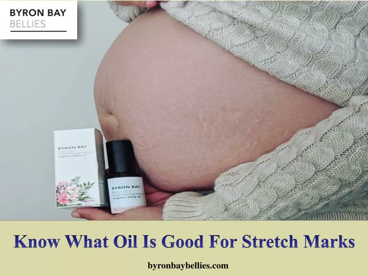 know what oil is good for stretch marks