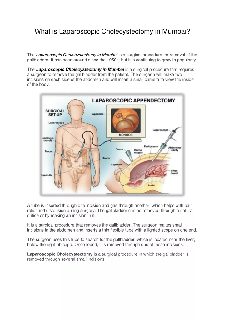 what is laparoscopic cholecystectomy in mumbai