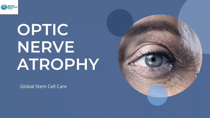 optic nerve atrophy