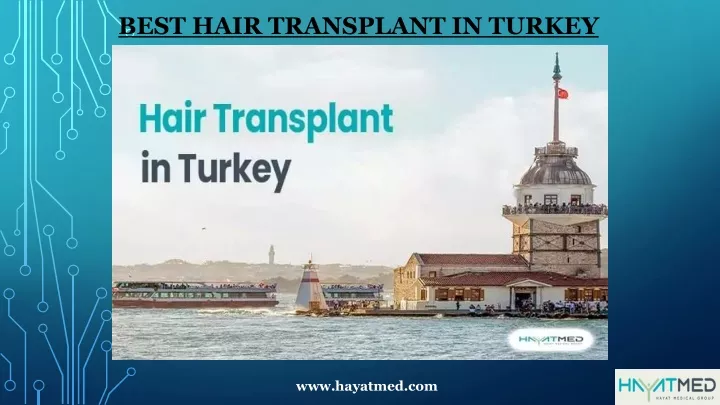best hair transplant in turkey