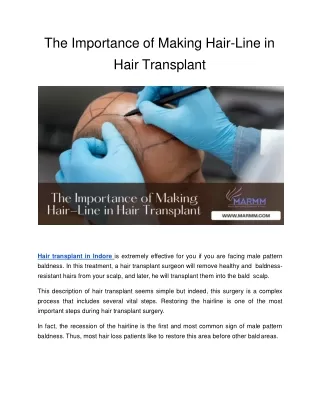 The Importance of Making Hair-Line in Hair Transplant