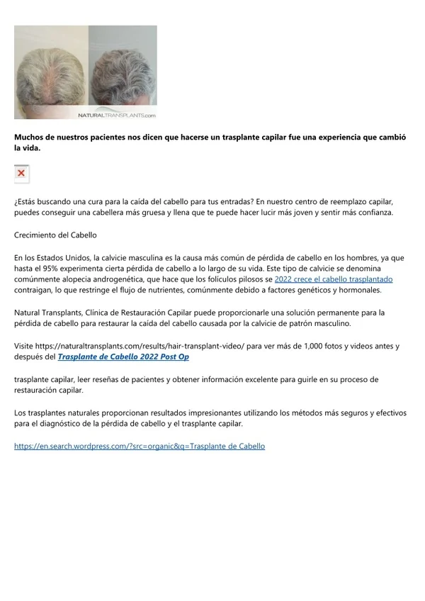 Hair Restoration Cost