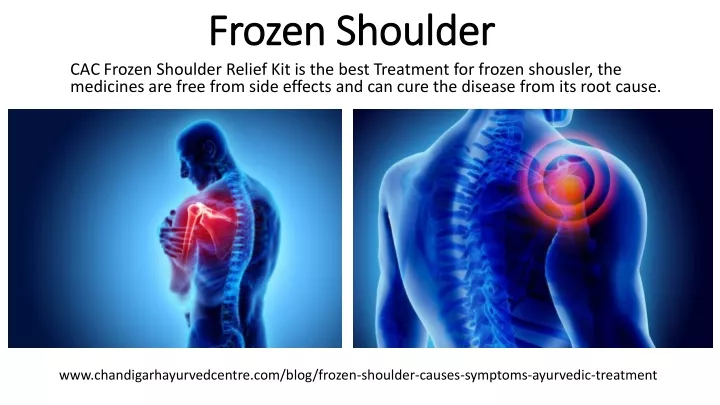 frozen shoulder