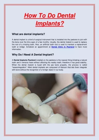 How To Do Dental Implants