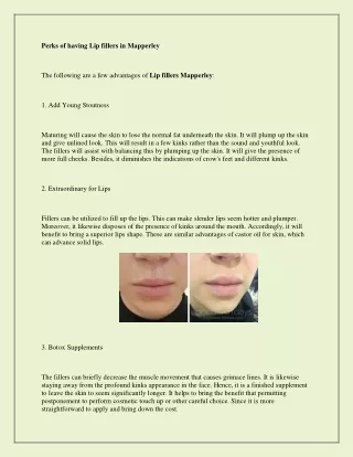 perks of having lip fillers in mapperley